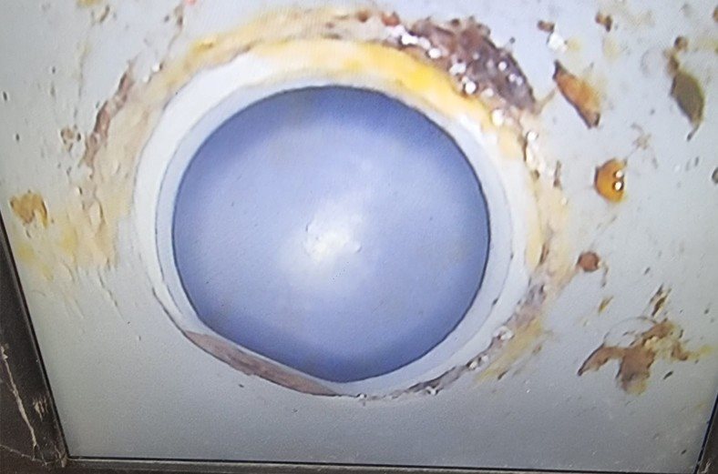 צילום ותיקון צנרת ביוב